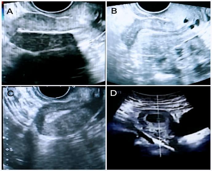 20260205620065.jpeg 图4.jpeg