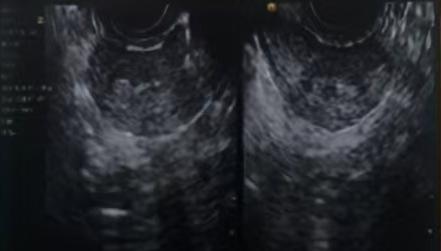 20260205727800.jpeg 图5.jpeg